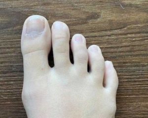 あなたの足の形は何型 ３つの種類 まな Foot