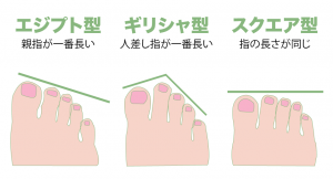 あなたの足の形は何型 ３つの種類 まな Foot